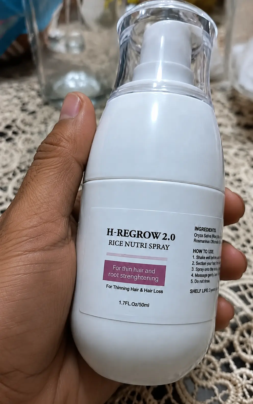 Resultado do Josué — cabelo crescendo de volta com H-Regrow