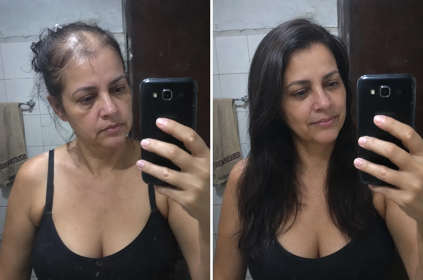 Transformação real: antes e depois do H-Regrow em apenas algumas semanas de uso