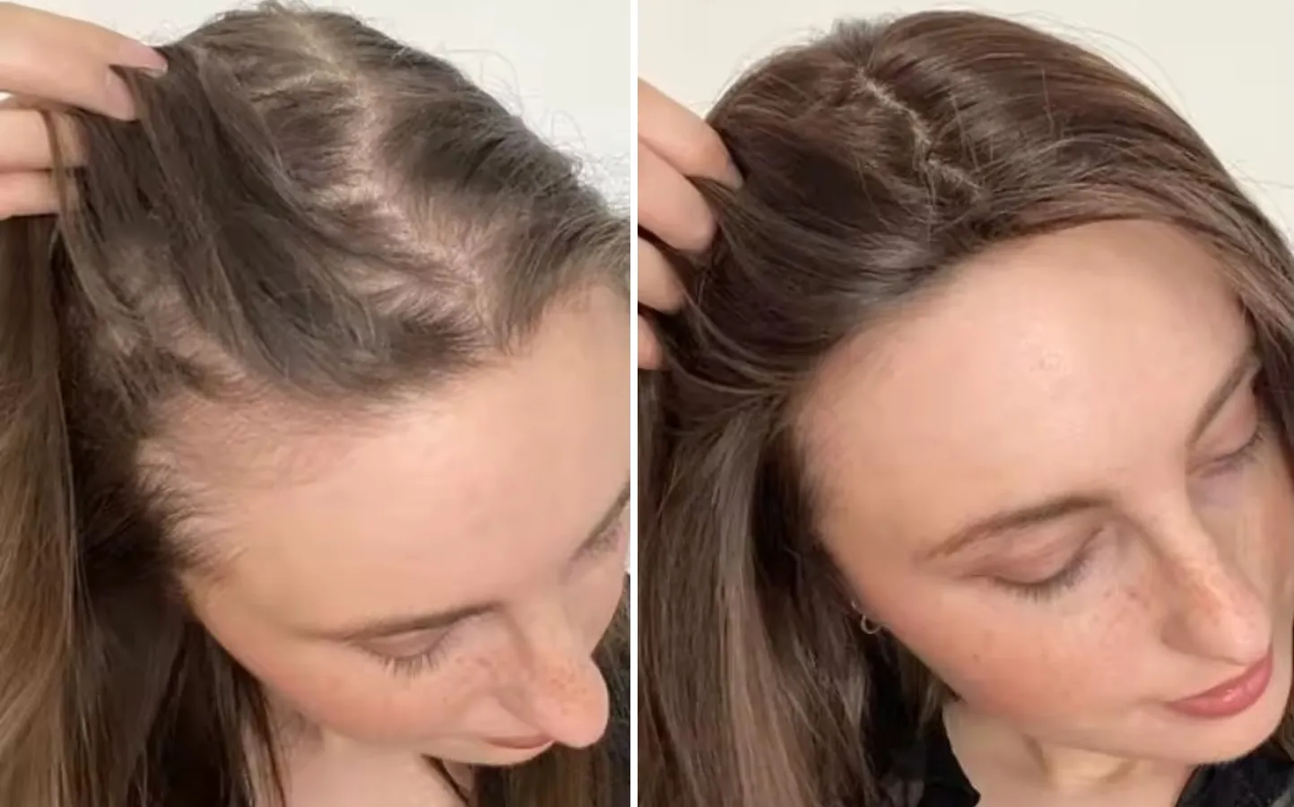 Resultado real de cliente — cabelo voltando a crescer cheio e saudável com H-Regrow