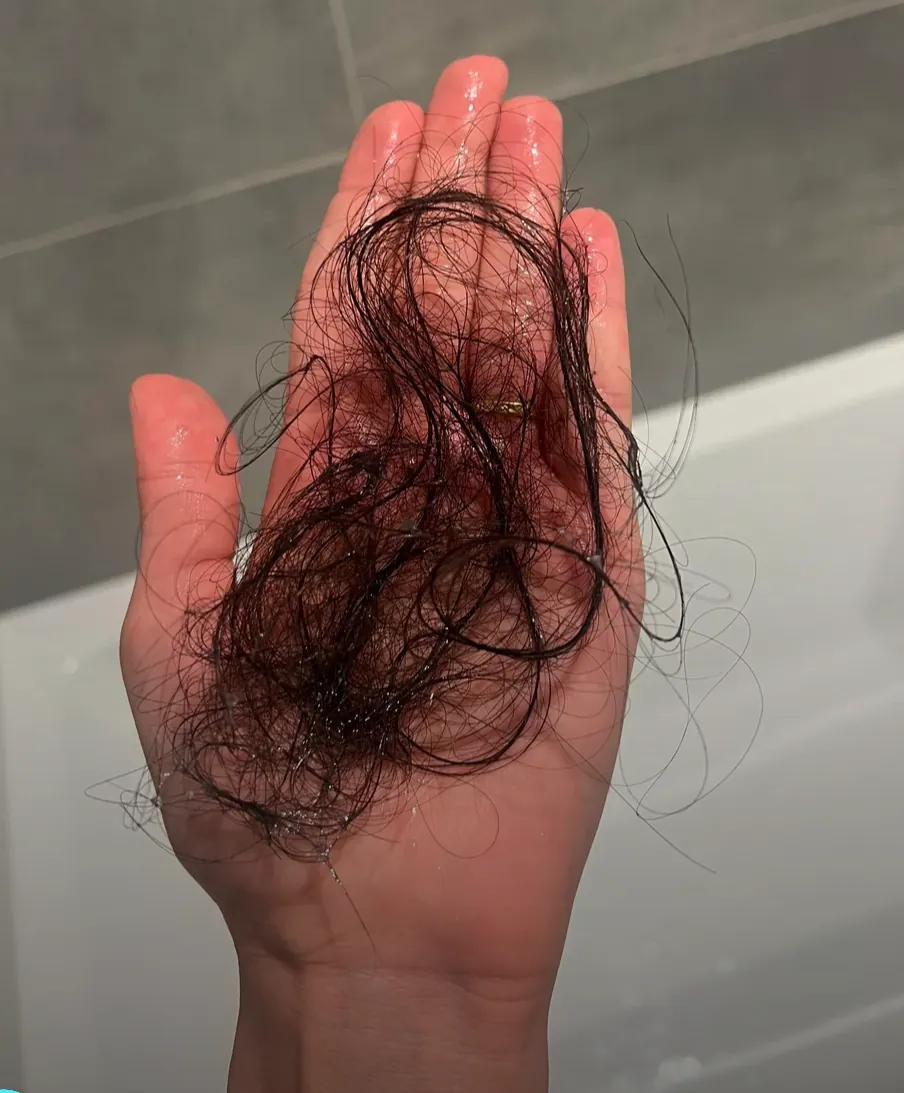 Cabelo entupindo o ralo do banheiro — a queda que não para de doer